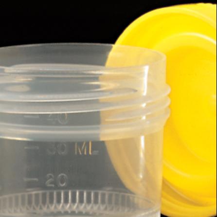 Контейнер для забору та пневмотранспортування патоморфологічних зразків, 40 мл, градуйований поліпропіленовий з жовтою гвинтовою кришкою, DELTALAB